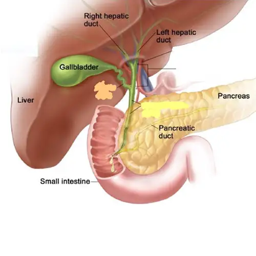 Gallbladder Removal Surgery in Anand