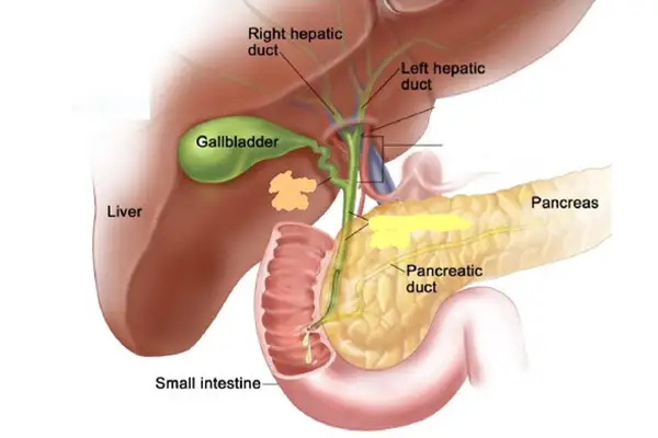 Gallbladder Removal Surgery in Anand