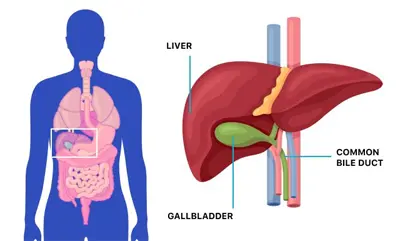 Gallstones Treatment in Nadiad